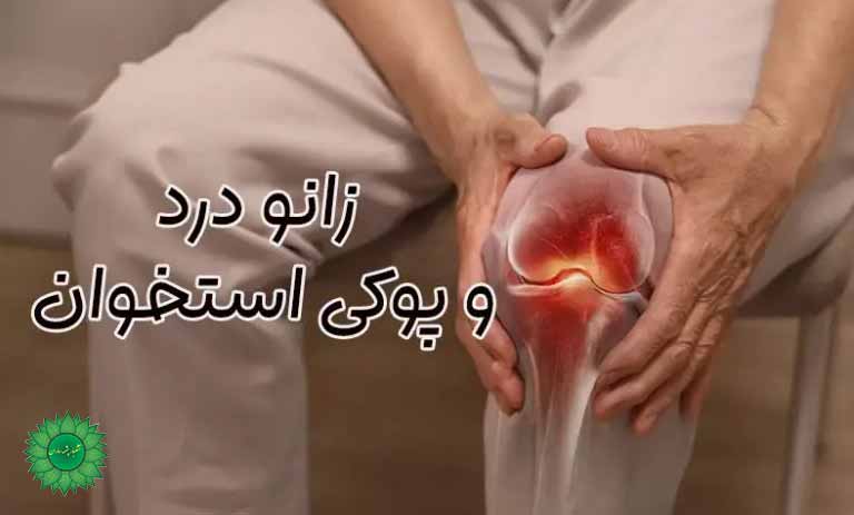 پوکی استخوان و راه های درمان خانگی