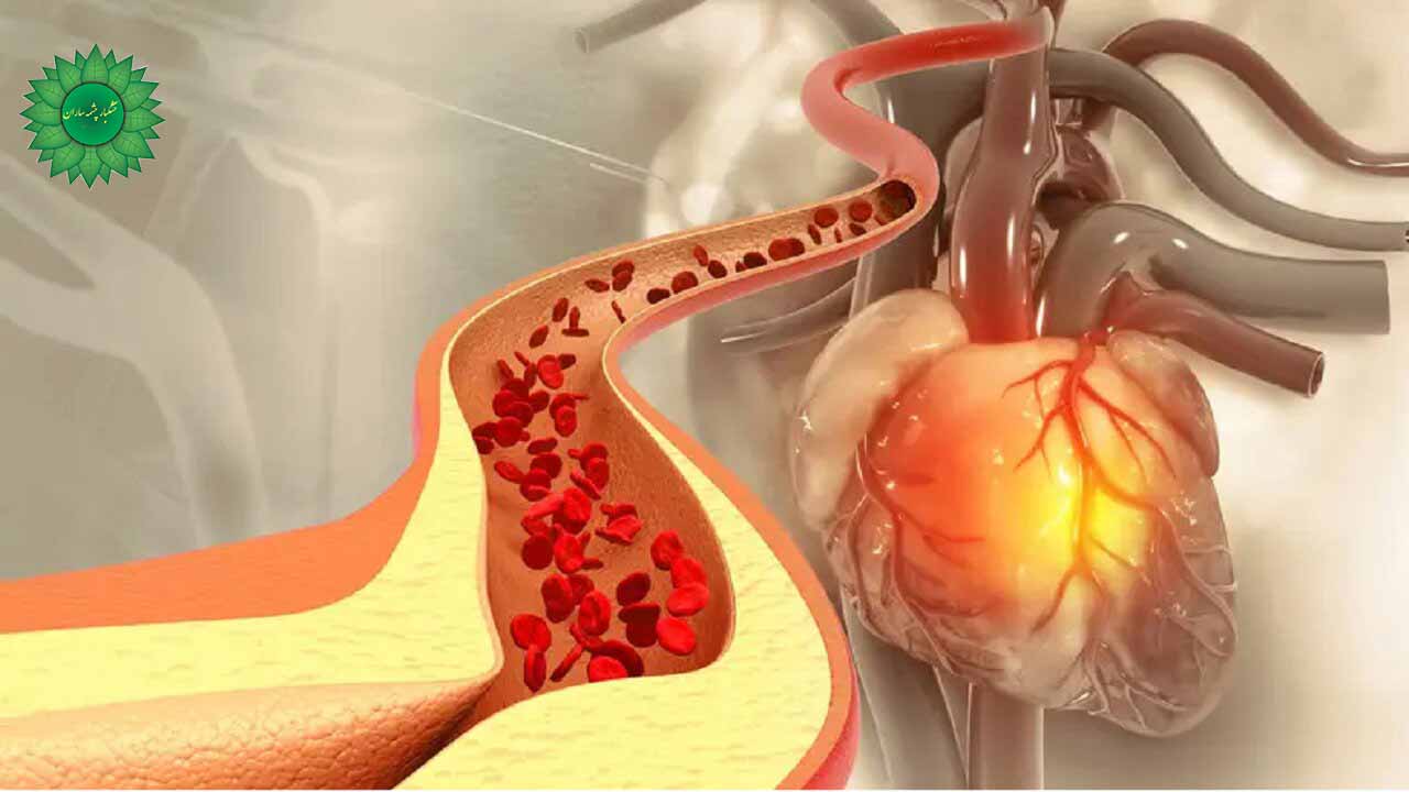 چربی خون را جدی بگیرید