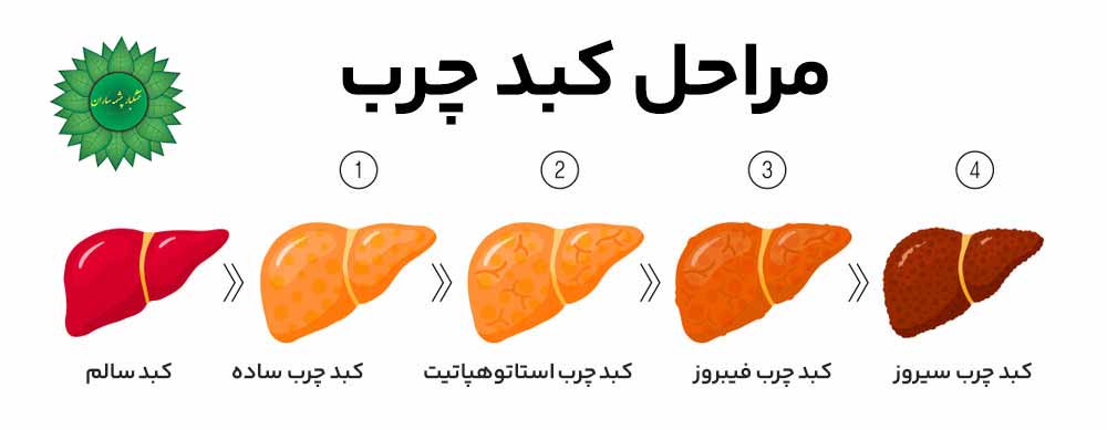 کبد چرب بیماری خاموش ک باید سریع درمان شود